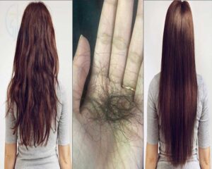 Women Hair Fall
